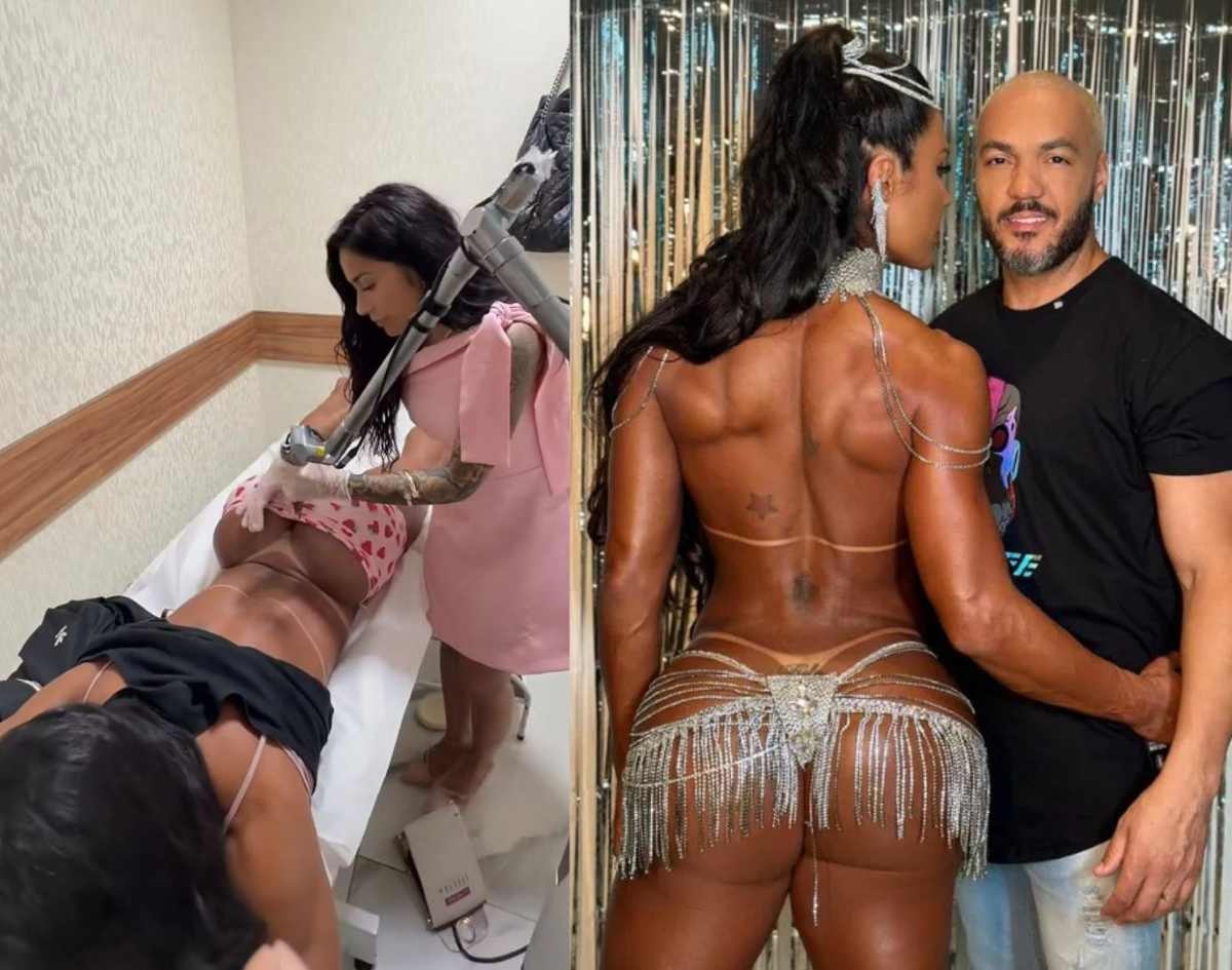Gracyanne Barbosa inicia remoção de tatuagem íntima em homenagem a Belo